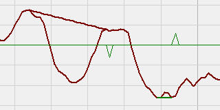 MACD Divergentie